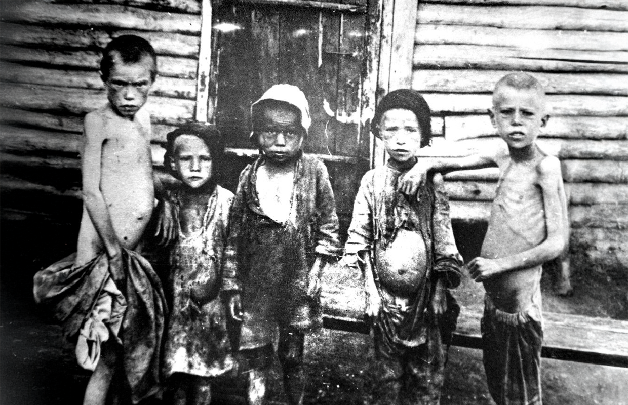 Опухлі від голоду діти