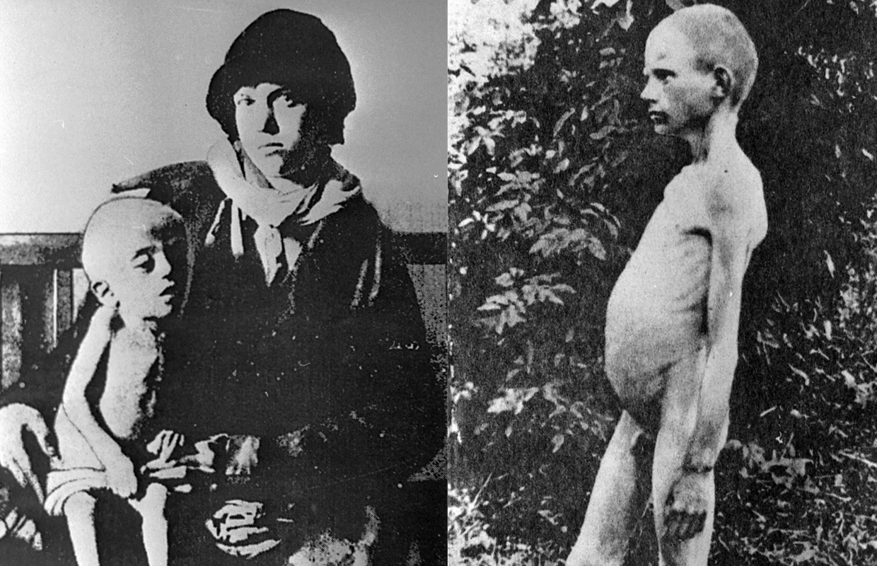Жінка з дитиною, виснаженою голодом. Місце і дата зйомки: УССР, 1932-1933 рр.
Голодний хлопчик в одному з сіл України. Місце і дата зйомки: УССР, 1932-1933 рр. 