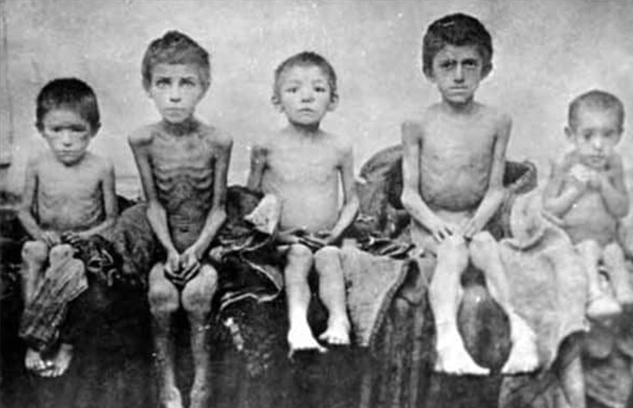 Опухлі від голоду діти