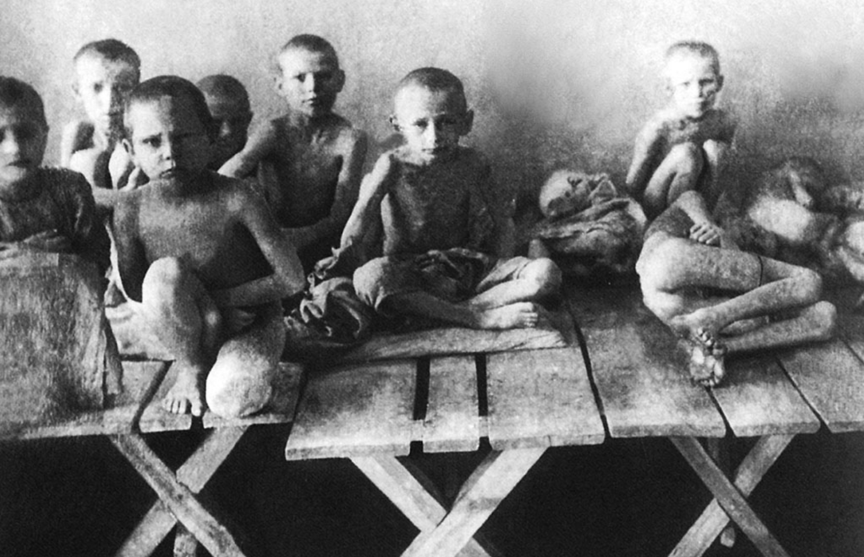 Опухлі від голоду діти